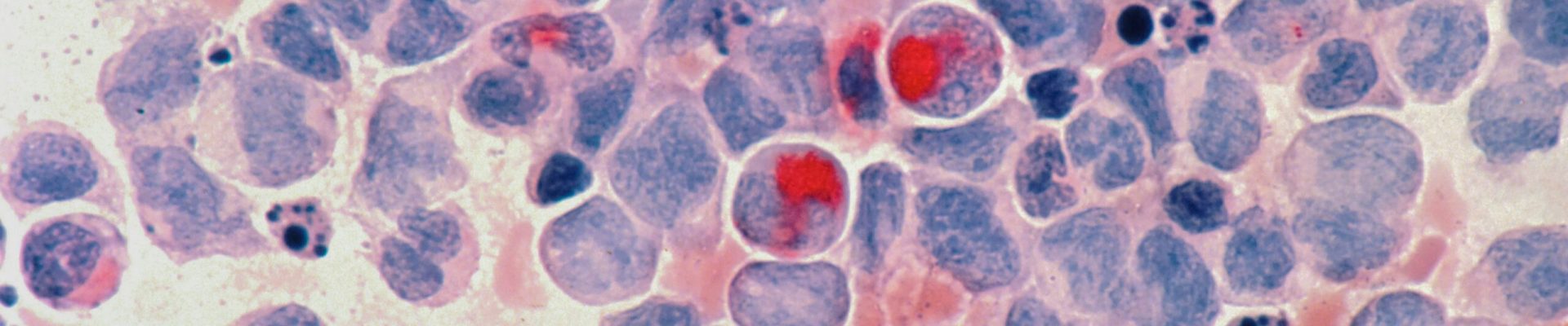 national-cancer-institute-mbL91Lg56zc-unsplash
